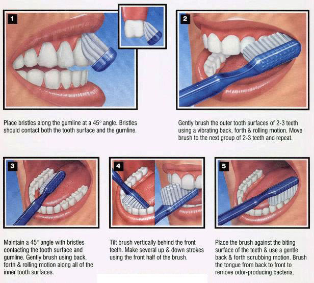 刷牙的正确方法,怎样正确地刷牙