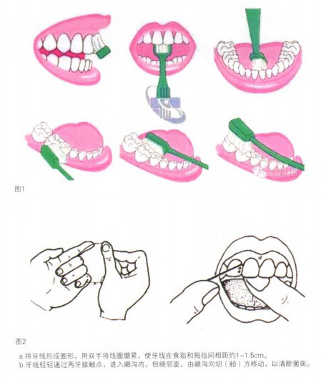 刷牙方法示意图